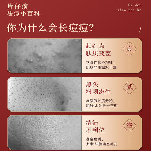 【国货之光】片仔癀袪痘三件套袪痘膏 袪痘贴 舒缓凝胶 改善痘肌淡化痘印女男士祛痘套装 商品图5