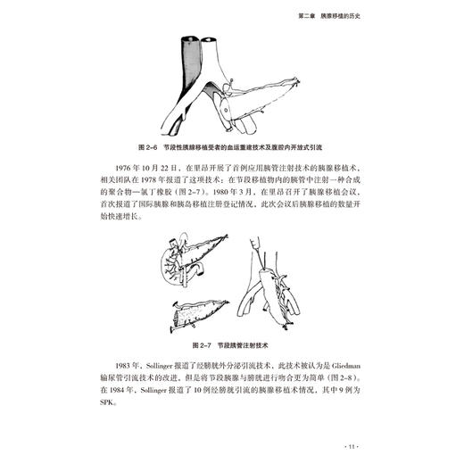 胰腺移植理论与实践精装2026版 宋文利 郑建明 主编 且配套胰腺移植手术教学视频 医学书籍 9787521458152 中国医药科技出版社 商品图4