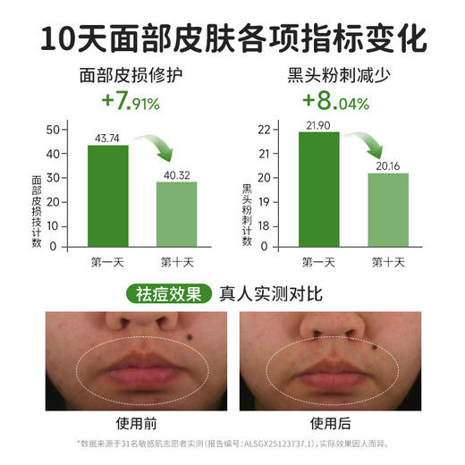 【会员价 · 祛痘安肌水乳套装】妈妈说 · 植萃祛痘安肌水乳套装 控油淡保湿化痘舒缓印敏感肌适用 商品图2