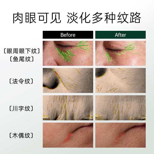 佰奥德BIOMD致臻青春焕新精华液超光精华抗皱紧致 30ml 商品图2