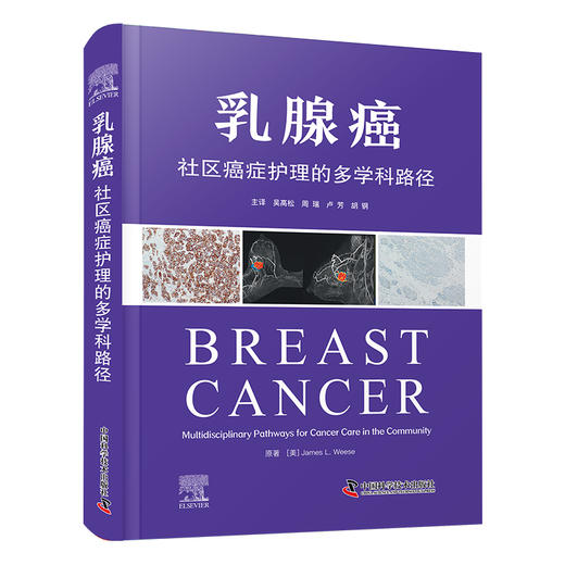 乳腺癌：社区癌症护理的多学科路径 商品图0