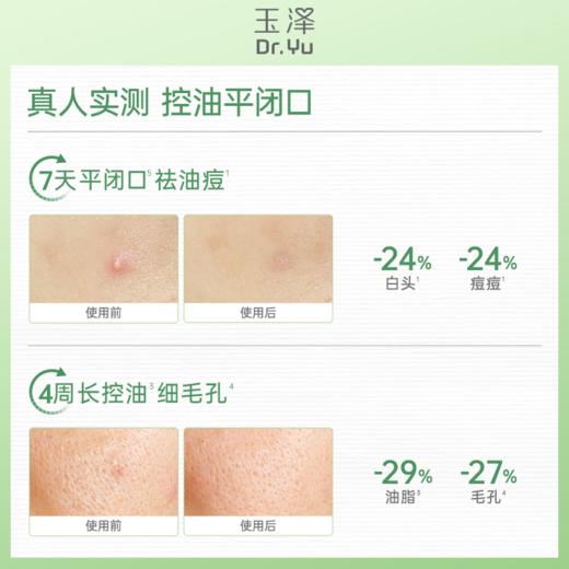 玉泽清痘调护平衡乳50ml 商品图2