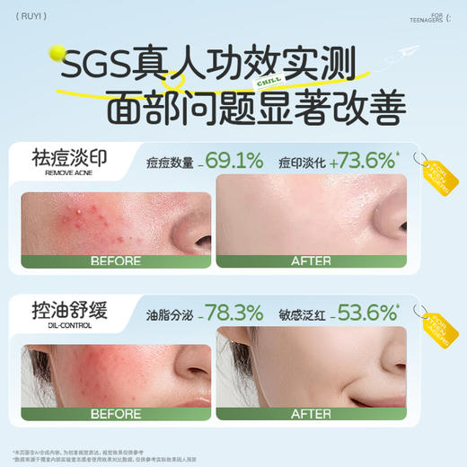 【全店🈵199-30】青少年控油祛痘水乳套装补水保湿洗面奶男女孩学生青春期护肤正品 商品图4