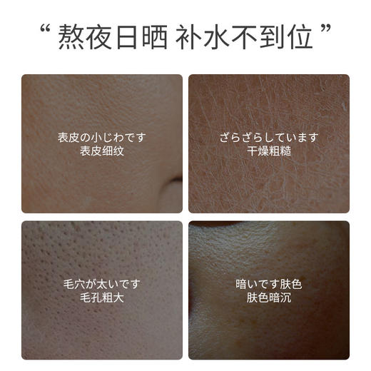 【沁透补水❗淡化暗沉】PFPX-a-熊果素莹靓无水精粹液滋润补水保湿熊果苷精华爽肤水。xa 商品图1