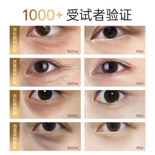 【胶原蛇毒眼膜】一瓶=3000+兰*蔻黑金效果！浓度高，淡化鱼尾纹、表情纹、眼下干纹及黑眼圈！提拉紧致，促进胶原刺激蛋白新生！方便有效且免洗！【QJ-J】 商品图3