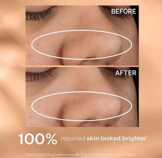 到手价159元 StriVectin Daily Reveal去角质棉片 60片 含AHA+BHA 美国采购，无中文标签，介意慎拍 商品图4