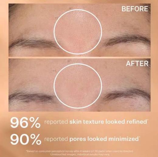 到手价159元 StriVectin Daily Reveal去角质棉片 60片 含AHA+BHA 美国采购，无中文标签，介意慎拍 商品图5