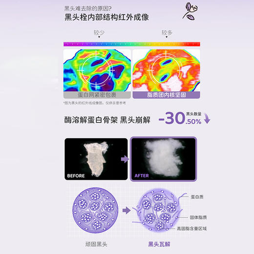 热卖爆品HelloKitty联名款ilso黑头导出液水/闭口水一苏溶解闭口粉刺收缩毛孔 商品图3