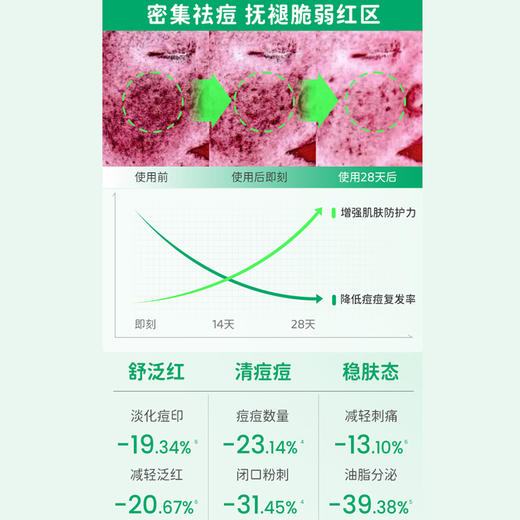 热卖爆品HelloKitty联名款ilso黑头导出液水/闭口水一苏溶解闭口粉刺收缩毛孔 商品图12