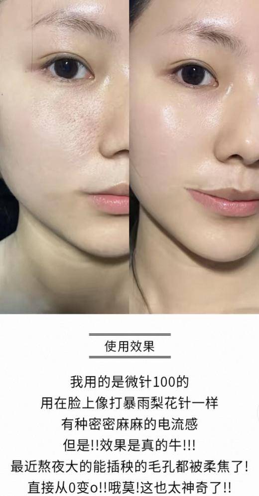 到手价209元 VT Reedle Shot 100韩国VT家的微针精华套装 60ml+30mI 美国采购，无中文标签，介意慎拍 商品图8