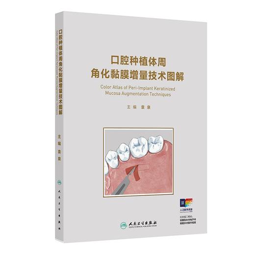 口腔种植体周角化粘膜增量技术图解  主编 袁泉  人卫出版 商品图0