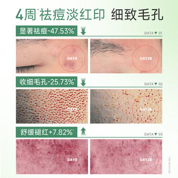 膜法世家绿豆泥膜135g 祛痘去黑头深层清洁控油 舒缓痘肌涂抹面膜送女生 商品图0