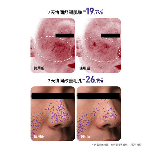 【花至新品】超导童颜炮+超膜刀 商品图5