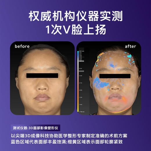 花至美容仪|肌提美容仪 商品图3