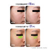 【花至新品】超导童颜炮+超膜刀 商品缩略图4