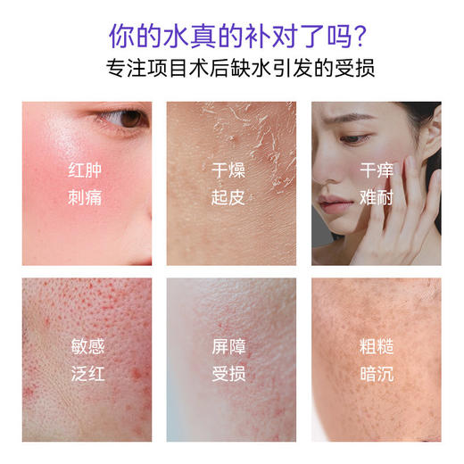 【会员专享】可孚医用喷雾重组胶原蛋白械字号术后创面补水修复敷料修护敏感肌 商品图1