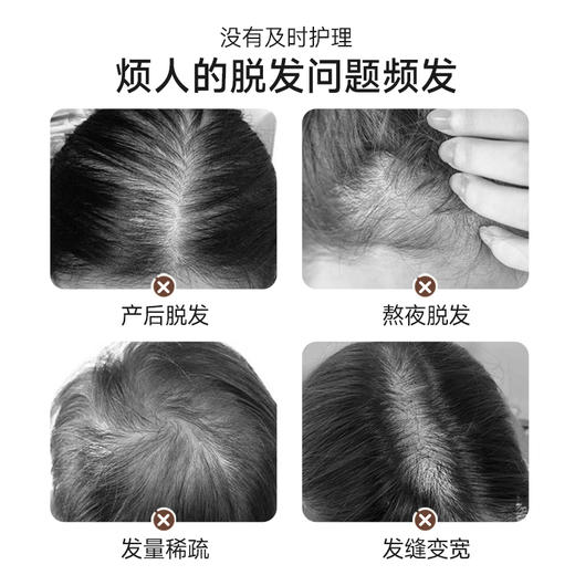 自然而然草本育发固发保健液育发养发保健膏全面升级4.0(健字号) 商品图4