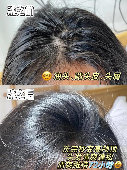 【美皮康专属】妮雀娜深层洗护套装「头脂溶洗液+氨基酸洗发泡泡」溶油洗发护发一步到位 商品图9