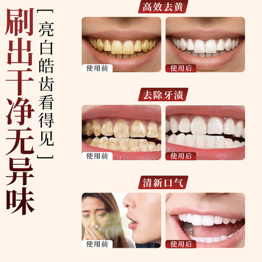 【呵护牙齿❗️健齿舒龈】草本牙粉固齿粉黄牙白牙结石洁牙粉清洁洗牙粉口腔清新。ya 商品图4