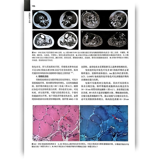 罕见病丛书—骨骼肌罕见病 张巍 主编 本书可以作为神经内科和儿科青年医生的入门学习工具书 9787565935312 北京大学医学出版社 商品图4