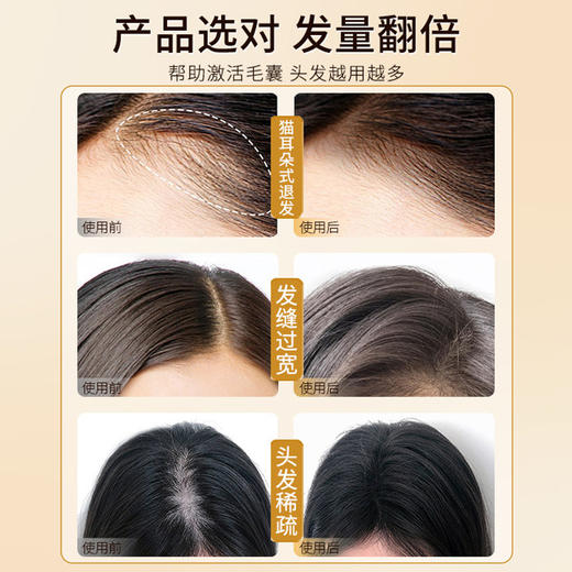 【防脱密发液】植物防脱固发精华液植物精粹科学防脱 商品图2
