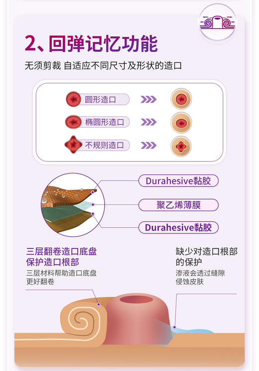 康维德二件式可塑平面造口底盘造口袋1+1套装 无需剪裁轻松塑形 商品图4