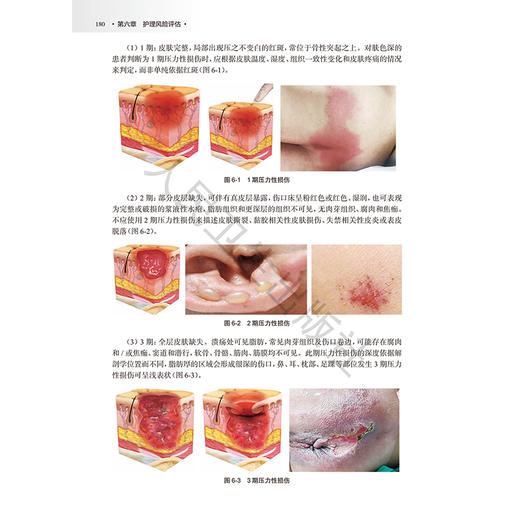 高级护理评估 杨朝霞 杨洪菊 系统介绍临床常见症状 护理问诊 护理查体 护理风险评估等护理评估的方法及技巧等 人民卫生出版社 商品图4