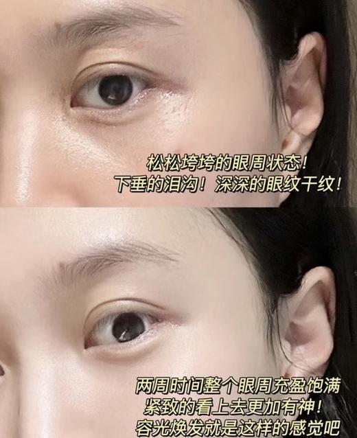 日本本土Shiseido/资生堂elixir怡丽丝尔第二代纯A小金管眼霜15g/22g抗皱保湿紧致淡化皱纹 商品图5