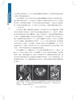 【新书预售 预计6月30发货】肿瘤急症外科学 商品缩略图2