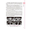 乳腺癌放射治疗原则与实践 王淑莲 本书引入了大量基于最新临床研究证据的实践指南，并配以典型翔实的临床案例等 人民卫生出版社 商品缩略图4