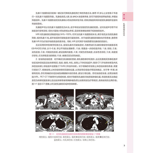 乳腺癌放射治疗原则与实践 王淑莲 本书引入了大量基于最新临床研究证据的实践指南，并配以典型翔实的临床案例等 人民卫生出版社 商品图4