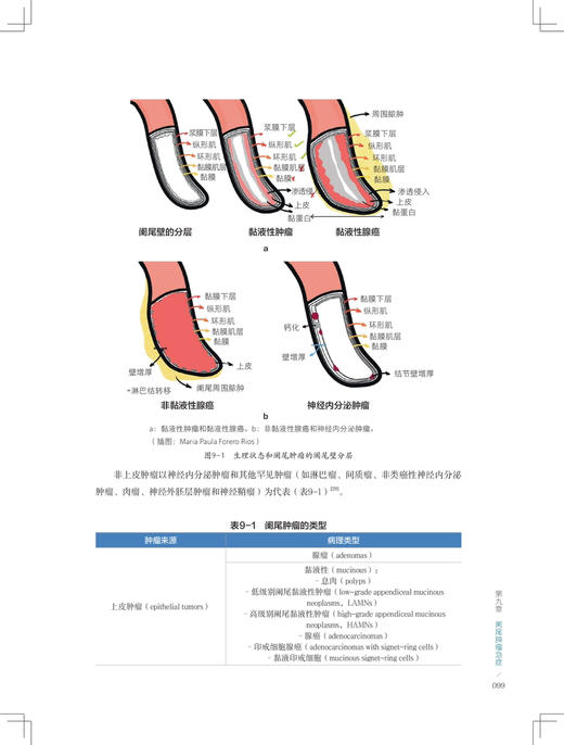 【新书预售 预计6月30发货】肿瘤急症外科学 商品图3