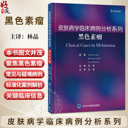 皮肤病学临床病例分析系列 黑色素瘤 林晶 主译 汇集黑色素瘤诊疗领域的研究成果与临床经验 黑色素瘤 病案 北京大学医学出版社 商品图0