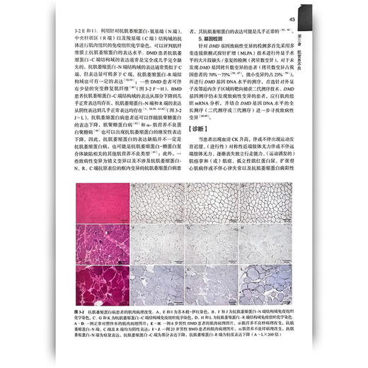 罕见病丛书—骨骼肌罕见病 张巍 主编 本书可以作为神经内科和儿科青年医生的入门学习工具书 9787565935312 北京大学医学出版社 商品图3