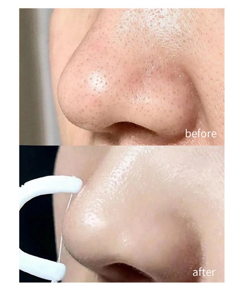 gWyWj/+nzNTvS8WG2Vtdg4tf/ZqhT2opzqDI