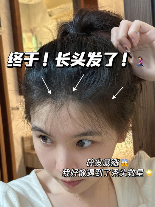 持证上岗【三井TRI-WELL防脱洗发水】横扫秃头怪、大油田!添加防脱界黑马可比落，防脱+固发+去屑+止痒+控油一瓶通通拿捏 商品图1