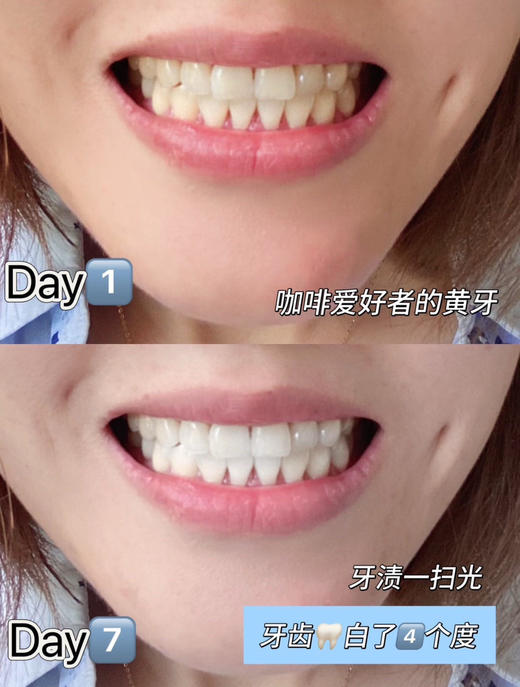 焕白牙膏3支 商品图1