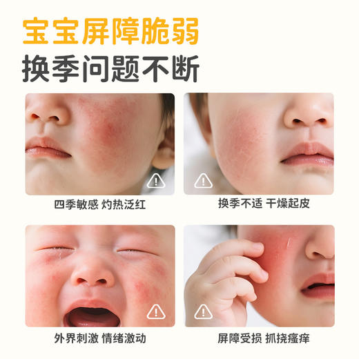 2瓶-20 到手118【出生即可用】蓓雀儿婴童轻润安心霜 （0m+） 商品图8