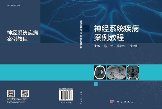 神经系统疾病案例教程 商品图3
