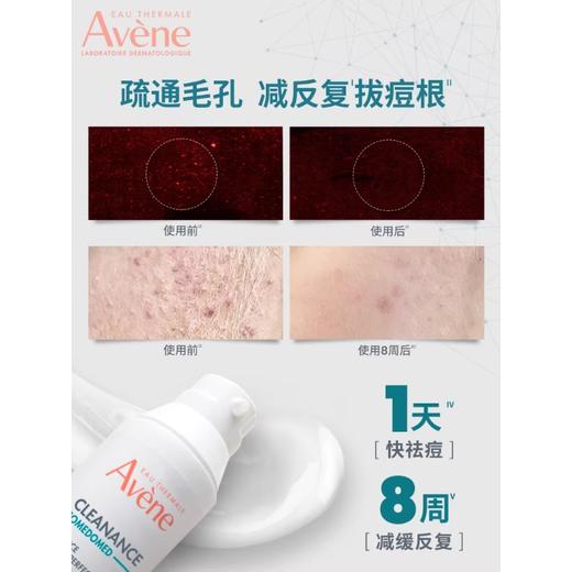 雅漾控油抗痘精华露30ml/瓶（效期至27年1月） 商品图3