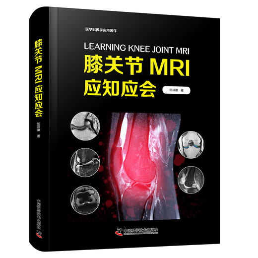 膝关节MRI应知应会 经典影像学著作 商品图1