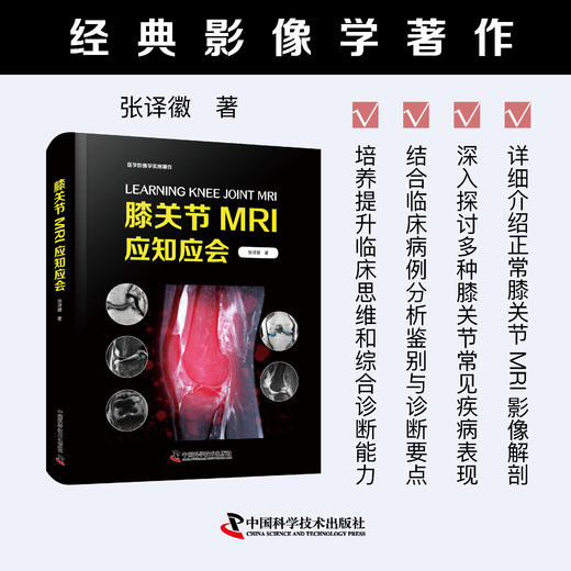 膝关节MRI应知应会 经典影像学著作 商品图0