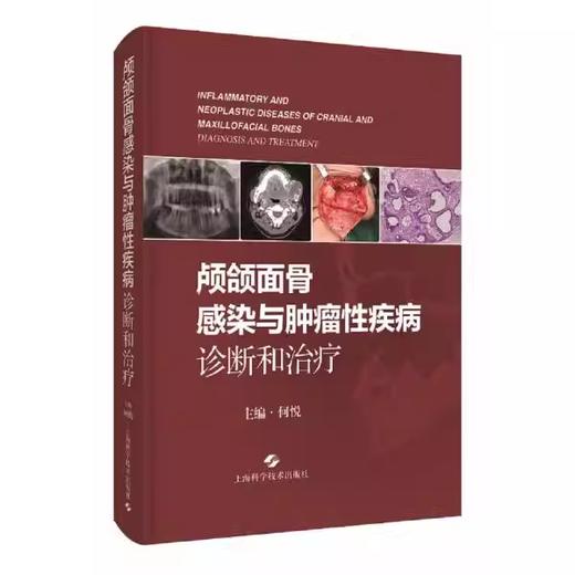 颅颌面骨感染与肿瘤性疾病诊断和治疗 商品图0