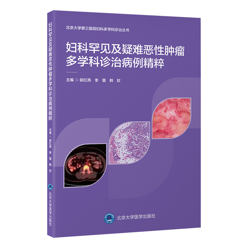 妇科罕见及疑难恶性肿瘤多学科诊治病例精粹