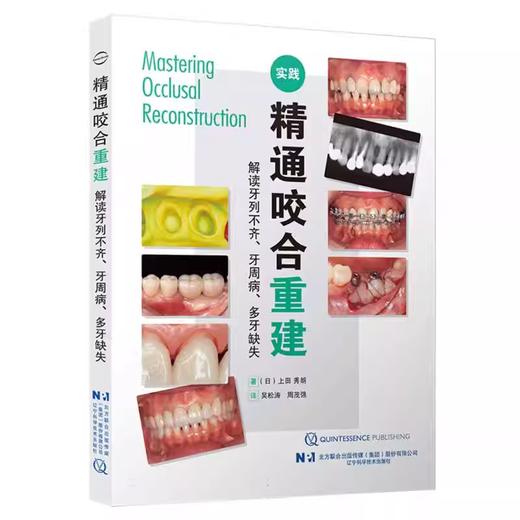 精通咬合重建——解读牙列不齐、牙周病、多牙缺失 商品图0