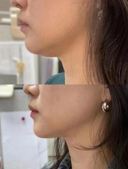 【清仓特价】润熙泉奢润轻龄塑颜涂抹面膜80g ， 有效期至：【2027年7月】 商品图5