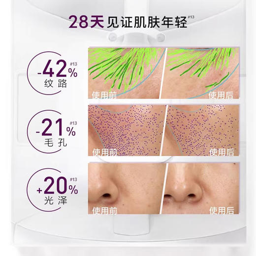 【欧莱雅四代小黑瓶肌底液】皮肤弹亮光滑 28天见证肌肤年轻15ml*2 商品图4