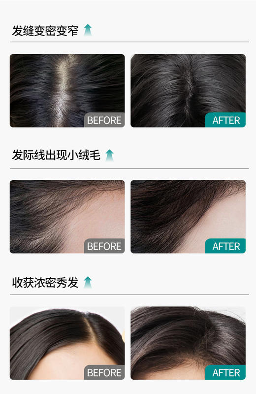 【防脱固发洗发露/精华液】持证防脱！防脱固发控油男女通用温和清洁，富含多肽精华+咖啡因精华，有效护理头皮和发丝，强健发根，减少脱发ZH 商品图6