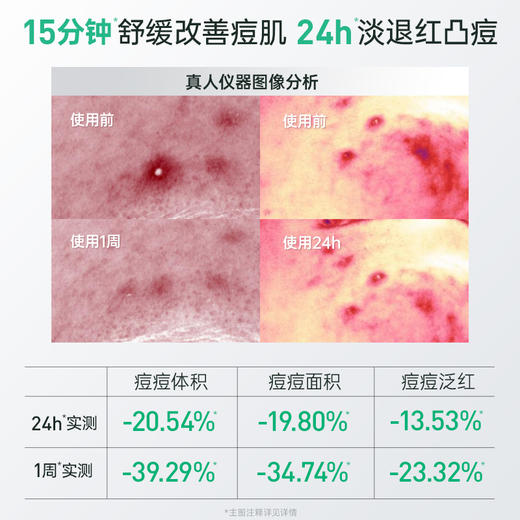 【余宇涵同款】膜法世家微生态祛痘修护纱布面膜 商品图3