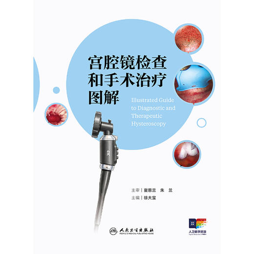 宫腔镜检查和手术治疗图解 商品图1